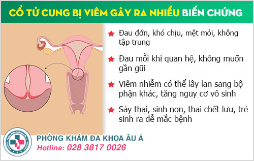 Viêm cổ tử cung