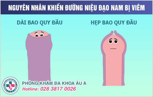 viêm đường niệu đạo ở nam giới