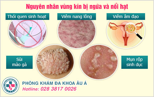 Vùng kín bị ngứa và nổi hạt