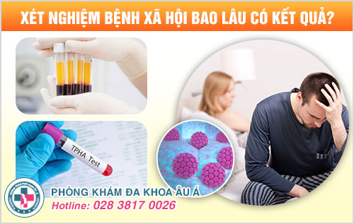 Xét nghiệm bệnh xã hội bao lâu có kết quả