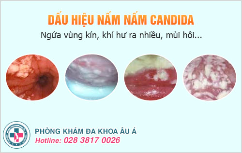 Xét nghiệm nấm Candida ở đâu