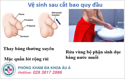 hướng dẫn cách thay băng sau khi cắt bao quy đầu tại nhà