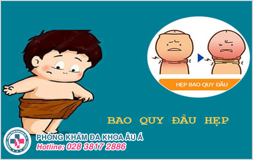 Hướng dẫn cách tự lột bao quy đầu tại nhà an toàn cho nam giới