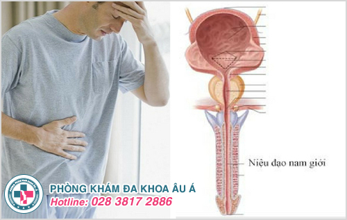 Trình trạng viêm niệu đạo gây khó tiểu cho người bệnh