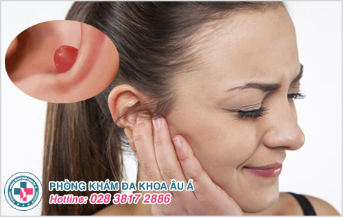 Mụn nhọt ở tai: hình ảnh, nguyên nhân và cách chữa trị