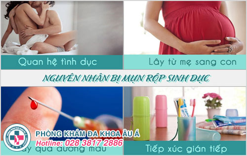 Nguyên nhân gây mụn rộp sinh dục