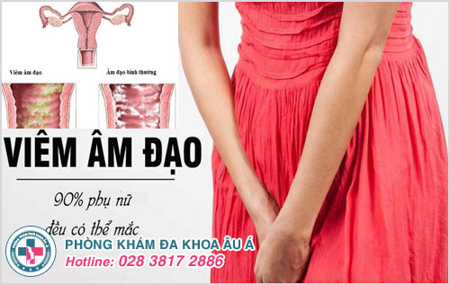 Ngứa "vùng kín" biểu hiện của bệnh viêm âm đạo