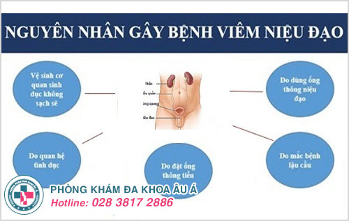 Nguyên nhân gây viêm niệu đạo ở nam giới