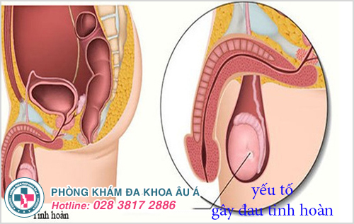 Nguyên nhân khiến tinh hoàn đau âm ỉ kéo dài