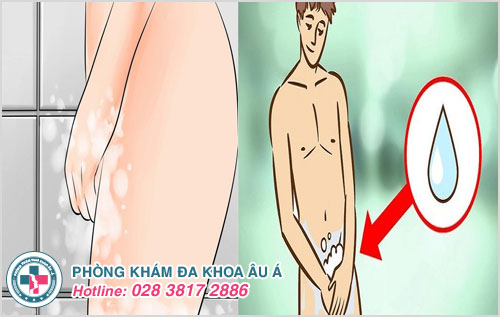 Vệ sinh vùng kín sạch sẽ là cách hạn chế bị ngứa ở dương vật hoặc âm đạo