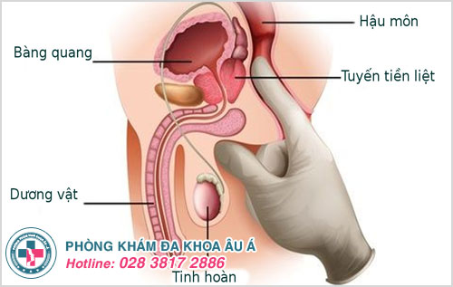 Tuyến tiền liệt bị sưng sẽ gây ảnh hưởng đến cơ quan sinh sản ở nam giới