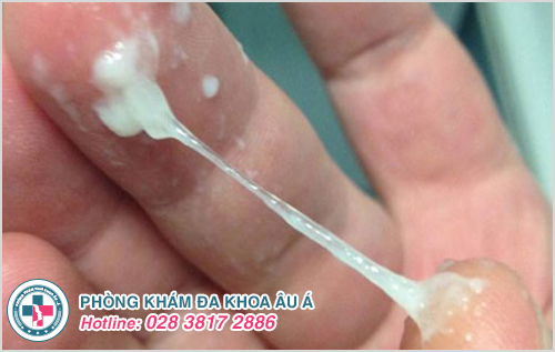 Quan hệ ra huyết trắng vón cục có sao không?