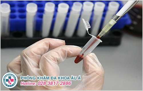 Xét nghiệm giang mai bằng phương pháp kiểm tra kháng thể (FTA – ABS):