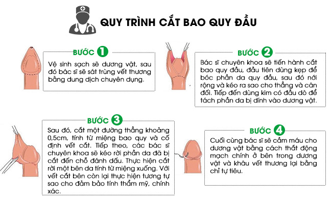 cắt bao quy đầu bị phù nề