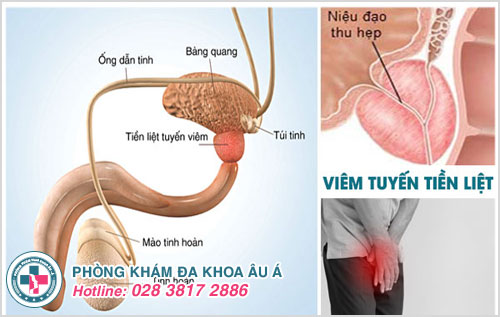 xuất tinh thấy đau buốt