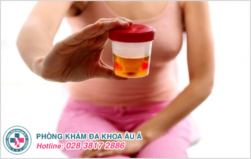 Thực phẩm giúp đẩy lùi ung thư bàng quang cực hiệu quả