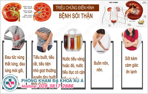 Tiểu buốt ra máu và đau bụng dưới là dấu hiệu bệnh gì