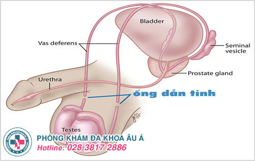tinh trùng có màu vàng và vón cục
