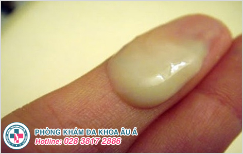 tinh trùng màu vàng