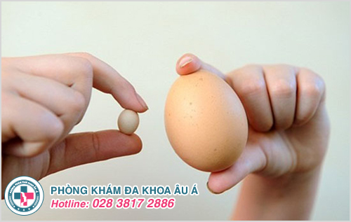 Hình ảnh minh họa tinh hoàn bên to bên nhỏ