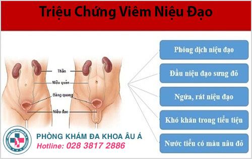 Các triệu chứng điển hình của bệnh viêm niệu đạo ở nam giới