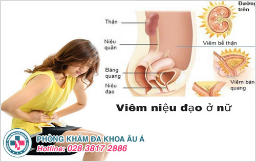 Triệu chứng đau bụng dưới, khó chịu ở các chị em khi bị viêm niệu đạo