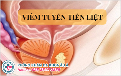 Bệnh viêm tuyến tiền liệt