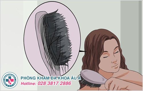 Rụng tóc do viêm da đầu phải làm sao?