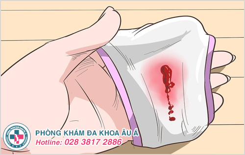 Xuất huyết âm đạo bất thường khi bị viêm lộ tuyến cổ tử cung 0.5cm
