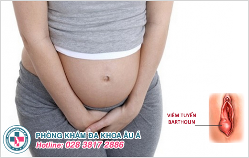 Viêm tuyến Bartholin khi mang bầu có nguy hiểm không?