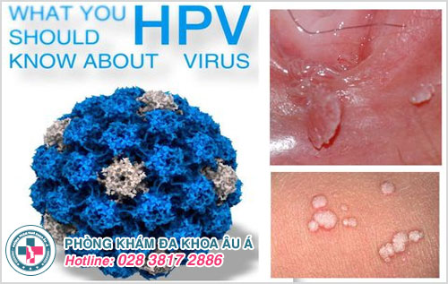 Virus HPV là nguyên nhân chính gây ra bệnh sùi mào gà nguy hiểm