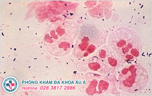 Hình minh họa vi khuẩn Chlamydia trachomatis gây bệnh