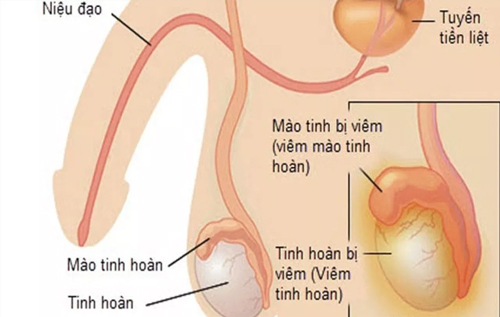 Hình ảnh minh họa tinh hoàn ở nam giới